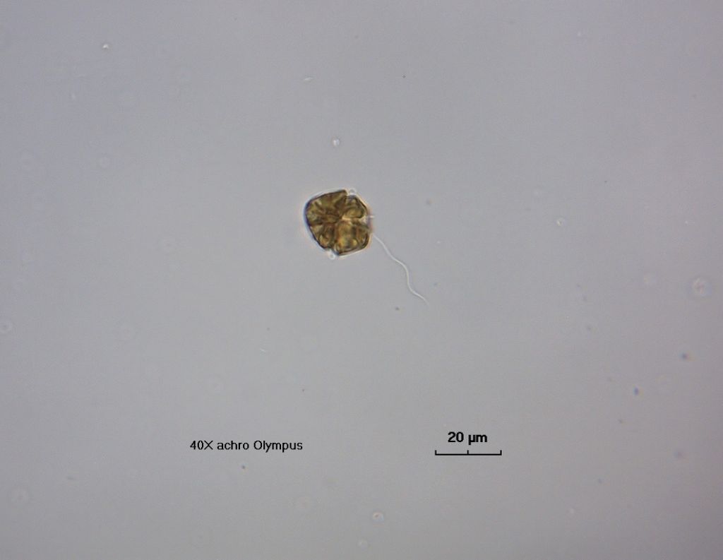 Gymnodinium breve (dinoflagellato)